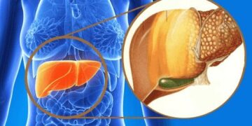 Las señales silenciosas del hígado graso no alcohólico