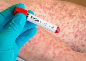 📰 📈 Jóvenes adultos concentran la mayor incidencia de casos de sífilis en Salta