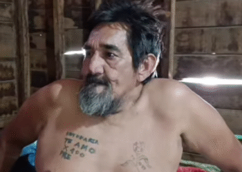 Dos años postrado y sin respuestas: Don José Maza denuncia abandono del sistema de salud y del municipio de Embarcación