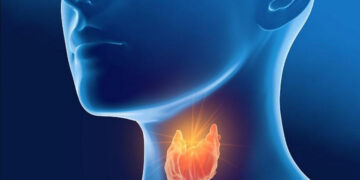 Hipotiroidismo: expertos de Harvard advierten sobre los riesgos de medicarse sin conocer la causa